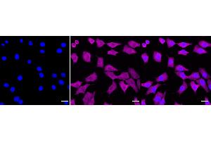 Immunocytochemical staining of C2C12 cells with Galectin 1 antibody (ABIN7799243), 1:1,000). (Recombinant LGALS1/Galectin 1 抗体)