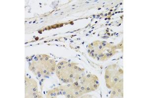 Immunohistochemistry of paraffin-embedded human gastric using MB21D1 antibody at dilution of 1:100 (x40 lens). (C6orf150 抗体)