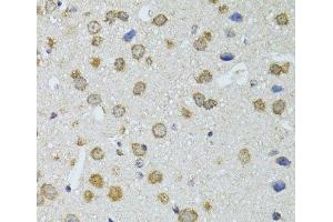 Immunohistochemistry of paraffin-embedded Mouse brain using RNASEL Polyclonal Antibody at dilution of 1:100 (40x lens). (RNASEL 抗体)