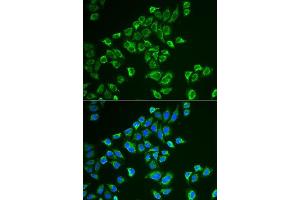 Immunofluorescence analysis of HeLa cells using TAGLN antibody. (Transgelin 抗体  (AA 1-201))