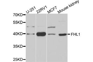 Western blot analysis of extracts of various cell lines, using FHL1 antibody. (FHL1 抗体)