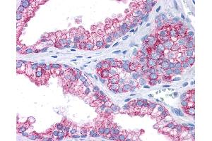 Anti-EPB41L2 antibody IHC of human prostate. (EPB41L2 抗体  (AA 481-530))