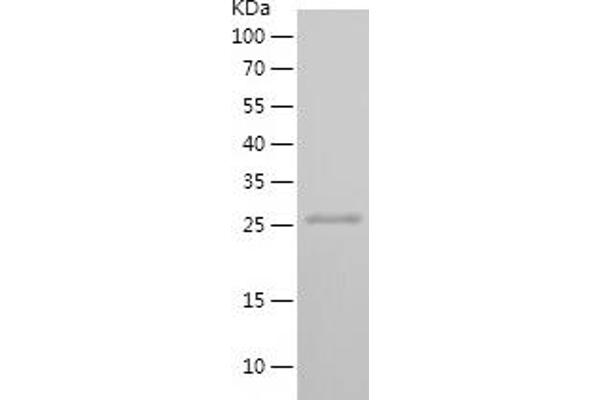 STT3B Protein (AA 480-541) (His-IF2DI Tag)