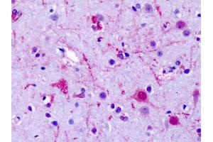 Anti-GPR75 antibody IHC of human brain, cortex, neurons. (GPR75 抗体  (Cytoplasmic Domain))