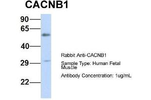 Host:  Rabbit  Target Name:  CACNB1  Sample Type:  Human Fetal Muscle  Antibody Dilution:  1. (CACNB1 抗体  (Middle Region))