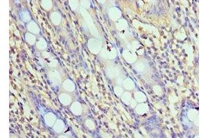 Immunohistochemistry of paraffin-embedded human colon tissue using ABIN7161654 at dilution of 1:100 (NLRC4 抗体  (AA 1-250))