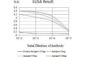 Black line: Control Antigen (100 ng),Purple line: Antigen (10 ng), Blue line: Antigen (50 ng), Red line:Antigen (100 ng) (CKM 抗体  (AA 1-381))