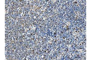 IHC analysis of ARHGAP45 using anti-ARHGAP45 antibody (ABIN7599740). (HMHA1 抗体  (AA 111-349))