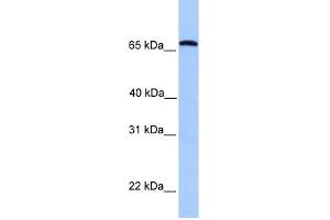 WB Suggested Anti-CCIN Antibody Titration: 0.