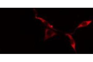 Immunofluorescence (fixed cells) (IF/ICC) image for anti-Potassium Voltage-Gated Channel, Subfamily G, Member 3 (KCNG3) (Internal Region) antibody (ABIN6258651)