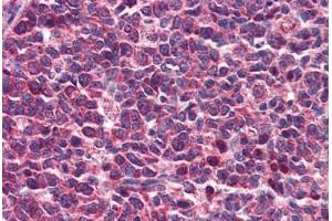 Human Tonsil: Formalin-Fixed, Paraffin-Embedded (FFPE) (DENND1B 抗体  (AA 144-193))