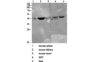 Western Blot (WB) analysis of specific cells using Antibody diluted at 1:1000. (CD72 抗体)