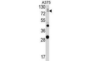 Image no. 1 for anti-Annexin A1 (ANXA1) (Middle Region) antibody (ABIN452740) (Annexin a1 抗体  (Middle Region))
