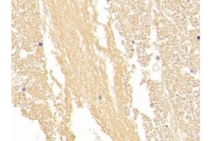 Detection of NSE in Human Cerebrum Tissue using Polyclonal Antibody to Enolase, Neuron Specific (NSE) (ENO2/NSE 抗体  (AA 1-434))