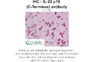 Image no. 2 for anti-Interleukin 23, alpha subunit p19 (IL23A) antibody (ABIN1735878) (IL23A 抗体)