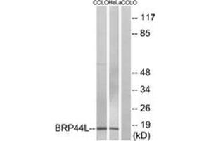 Western Blotting (WB) image for anti-Brain Protein 44-Like (BRP44L) (AA 11-60) antibody (ABIN2890168) (BRP44L 抗体  (AA 11-60))