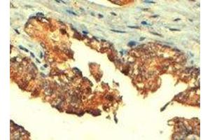 ABCC4 polyclonal antibody  (4 ug/mL) staining of paraffin embedded human prostate. (ABCC4 抗体  (C-Term))