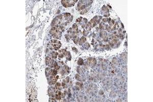 Immunohistochemical staining of human pancreas with SLC25A29 polyclonal antibody  shows moderate cytoplasmic positivity in exocrine glandular cells at 1:20-1:50 dilution. (SLC25A29 抗体)