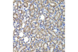 Immunohistochemistry of paraffin-embedded rat kidney using COPS2 antibody (ABIN5974233) at dilution of 1/100 (40x lens). (COPS2 抗体)