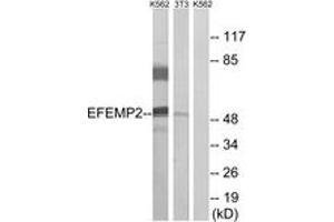 Western blot analysis of extracts from K562/NIH-3T3 cells, using EFEMP2 Antibody. (FBLN4 抗体  (AA 91-140))