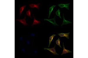 ABIN6266279 and ABIN6277274 staining 3 by IF/ICC. (TGFBI 抗体  (N-Term))
