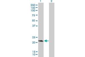 Western Blot analysis of RAB7L1 expression in transfected 293T cell line by RAB7L1 MaxPab polyclonal antibody. (RAB7L1 抗体  (AA 1-203))