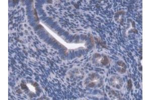 Detection of GBP4 in Mouse Uterus Tissue using Polyclonal Antibody to Guanylate Binding Protein 4 (GBP4) (GBP4 抗体  (AA 1-304))
