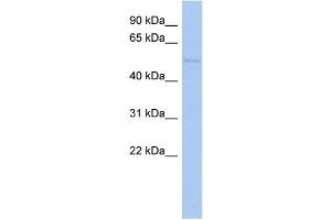 WB Suggested Anti-TIGD4 Antibody Titration: 0. (TIGD4 抗体  (N-Term))