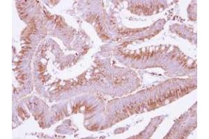 Image no. 1 for anti-Cytochrome C Oxidase Assembly Homolog 15 (COX15) (AA 178-410) antibody (ABIN1497579) (COX15 抗体  (AA 178-410))