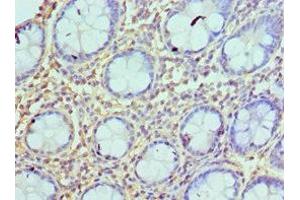 Immunohistochemistry of paraffin-embedded human colon tissue using ABIN7145136 at dilution of 1:100 (Azurocidin 抗体  (AA 27-251))