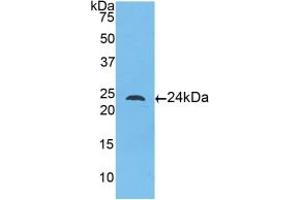Western blot analysis of recombinant Human TLR5. (TLR5 抗体  (AA 46-205))