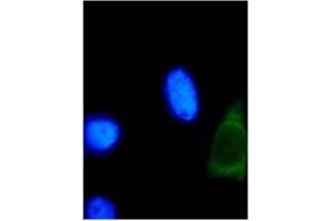 Immunofluorescence (IF) image for anti-Human Papilloma Virus 18 E2 (HPV-18 E2) (AA 1-83) antibody (ABIN457548)