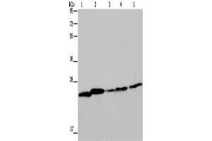 Western Blotting (WB) image for anti-rho GDP Dissociation Inhibitor (GDI) alpha (ARHGDIA) antibody (ABIN2423525)