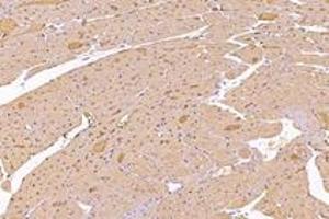 Immunohistochemistry (Paraffin-embedded Sections) (IHC (p)) image for anti-Kinesin Family Member 5B (KIF5B) antibody (ABIN7074440)