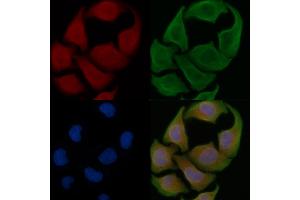 ABIN6259308 and ABIN6275426 staining Hela cells by IF/ICC. (MOV10L1 抗体  (Internal Region))