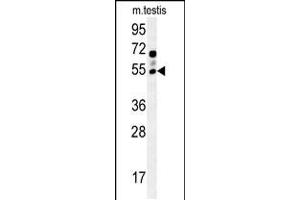 Western Blotting (WB) image for anti-gamma-aminobutyric Acid (GABA) A Receptor, gamma 2 (GABRG2) (AA 198-224) antibody (ABIN5536152)