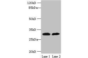 Western blot All lanes: TRNAU1AP antibody at 12 μg/mL Lane 1: MCF-7 whole cell lysate Lane 2: Jurkat whole cell lysate Secondary Goat polyclonal to rabbit IgG at 1/10000 dilution Predicted band size: 33, 21 kDa Observed band size: 33 kDa (TRNAU1AP 抗体  (AA 33-156))
