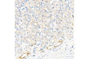 Immunohistochemistry analysis of paraffin-embedded rat stomach using Plectin Rabbit mAb at dilution of 1:1000 (40x lens). (PLEC 抗体)