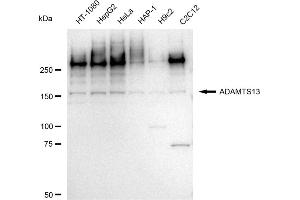 Western blotting analysis using ADAMTS13 antibody (ABIN7797504).