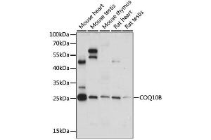 Western blot analysis of extracts of various cell lines, using COQ10B antibody. (COQ10B 抗体)