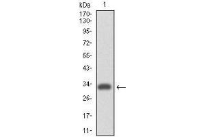 Western blot analysis using ITGA4 mAb against human ITGA4 (AA: 926-978) recombinant protein. (ITGA4 抗体)