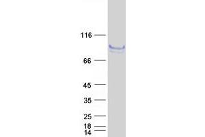 Validation with Western Blot