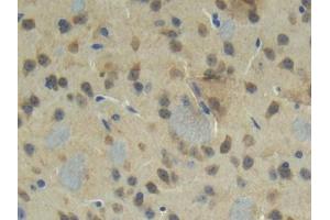 DAB staining on IHC-P; Samples: Mouse Cerebrum Tissue (CTGF 抗体  (AA 245-346))