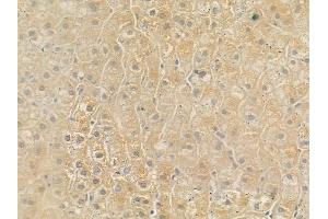 ABIN6257617 and ABIN6275640 at 1/100 staining human normal liver tissue by IHC-P. (MTERF 抗体  (Internal Region))