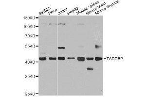 Western blot analysis of extracts of various cell lines, using TARDBP antibody. (TARDBP 抗体  (AA 1-100))