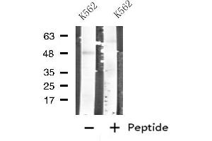 Western blot analysis of extracts from K562 cells, using CARBOXYPEPTIDASE A1 antibody. (CPA1 抗体  (Internal Region))