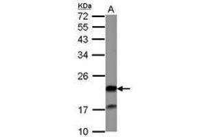 Image no. 1 for anti-Grancalcin, EF-Hand Calcium Binding Protein (GCA) (AA 7-217) antibody (ABIN1498410) (Grancalcin 抗体  (AA 7-217))