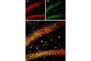 Multiplex staining of BDNF and proBDNF in rat hippocampus - Immunohistochemical staining of rat hippocampal dentate gyrus perfusion-fixed frozen sections using Guinea pig Anti-BDNF Antibody (ABIN7042969, ABIN7045379 and ABIN7045380), (1:300) and Anti-proBDNF Antibody (ABIN7043558, ABIN7044753 and ABIN7044754), (1:200). (Pro BDNF 抗体  (Pro-Domain))