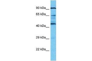 Western Blotting (WB) image for anti-KRAB-A Domain Containing 2 (KRBA2) (N-Term) antibody (ABIN2791626) (KRBA2 抗体  (N-Term))