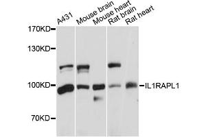 Western blot analysis of extracts of various cell lines, using IL1RAPL1 antibody (ABIN5971751) at 1:3000 dilution. (IL1RAPL1 抗体)